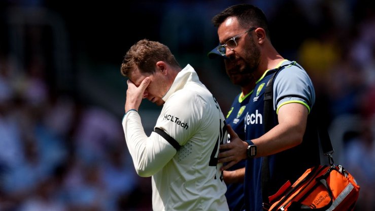 A distressed Steve Smith was in real pain after the compound fracture of his finger.